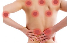 fibromialgia