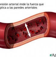 hipertension
