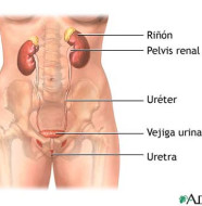 incontinencia urinaria